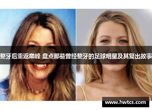 整牙后重返巅峰 盘点那些曾经整牙的足球明星及其复出故事